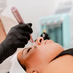 Dermapen con Activos