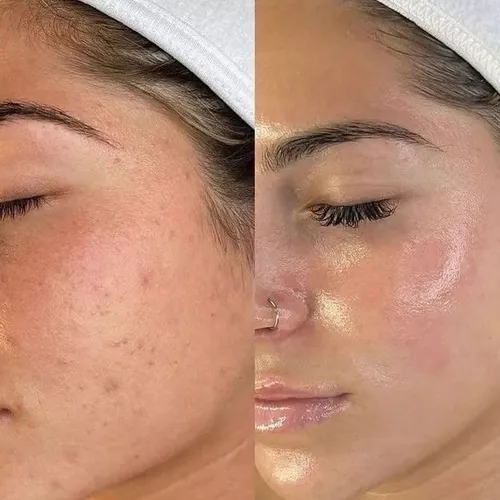Chau Granitos