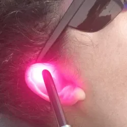 Pack Terapia laser mensual x 4 