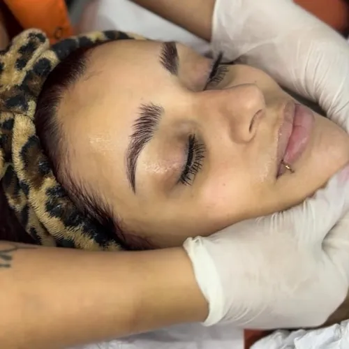 Limpieza facial profunda con extracciones 