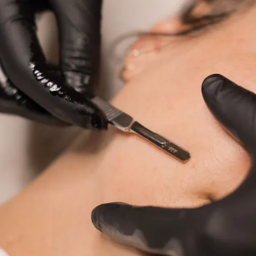 Higiene con Dermaplaning 