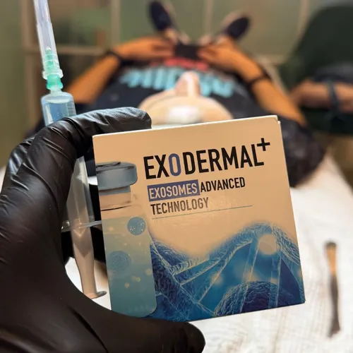 Exosomas (tratamiento)