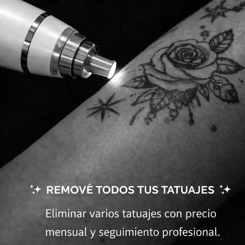 Plan eliminación de tatuajes 