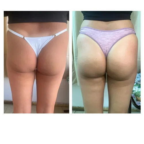 Glúteos UP (solo glúteos y piernas) 