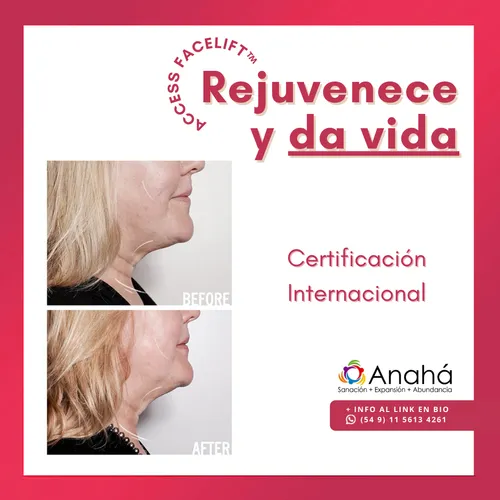 Pack Beneficio: Access Facelift