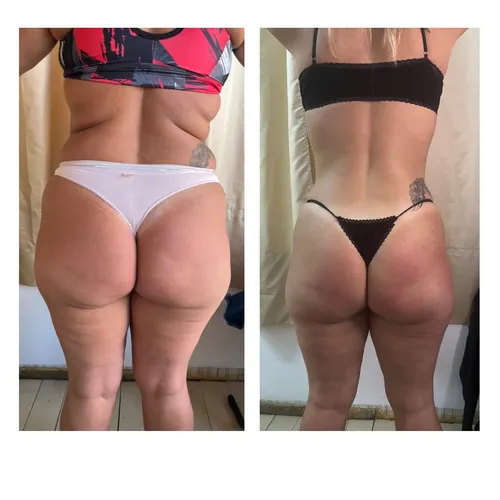 Definición total (abdomen+gluteos) 