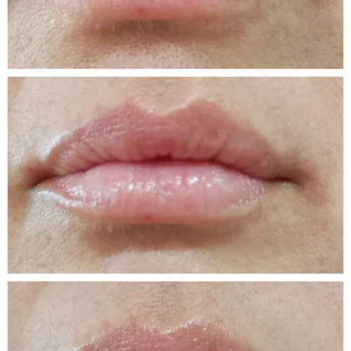 hidratación de labios