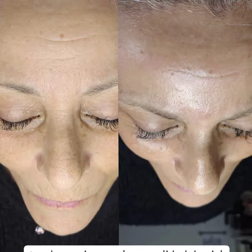 Si querés Glow!! Facial Coreano 