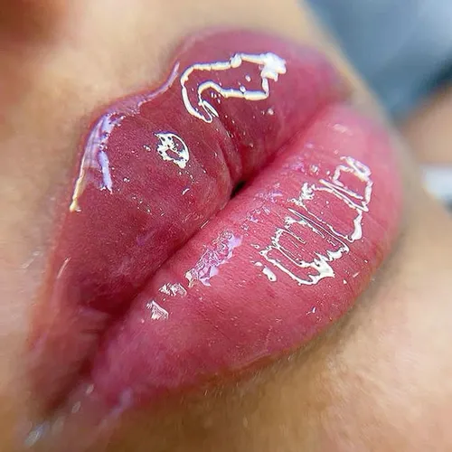 Lips Boost 