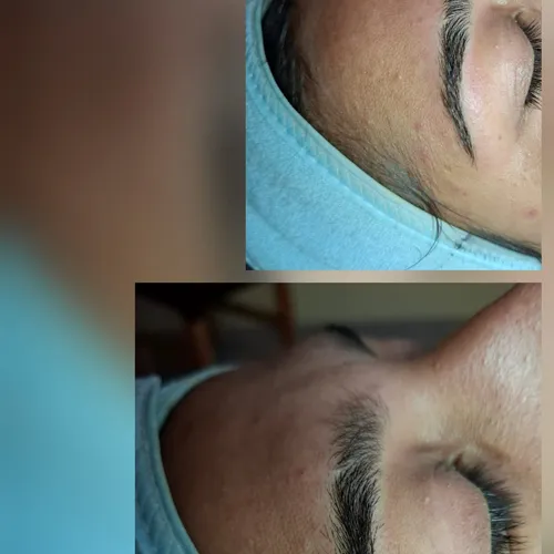 Limpieza facial profunda + per