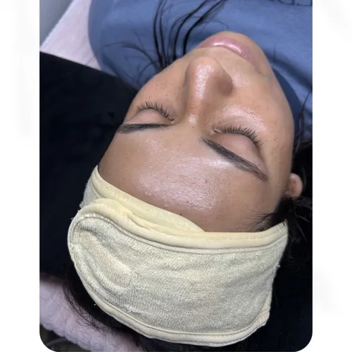 Microdermoabrasión | Peeling renovador | iluminador 