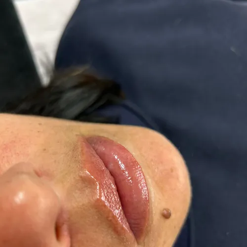 Hidratación profunda de labios 