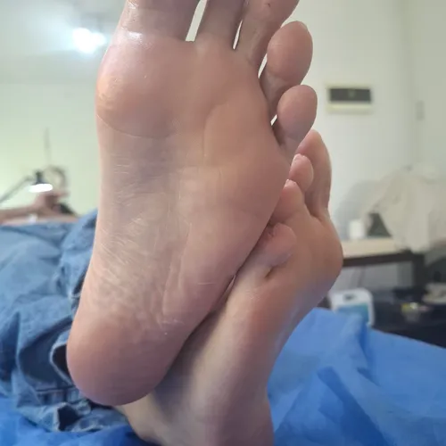 Remoción de callosidades y queratosis exf