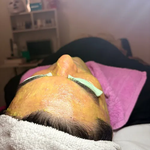 Yellow peeling