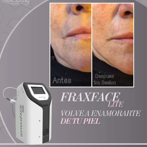FraxFace 