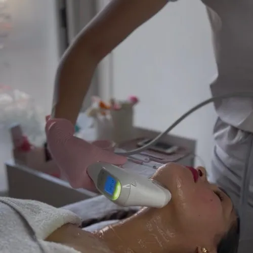 HIFU: Rostro, papada, cuello y escote