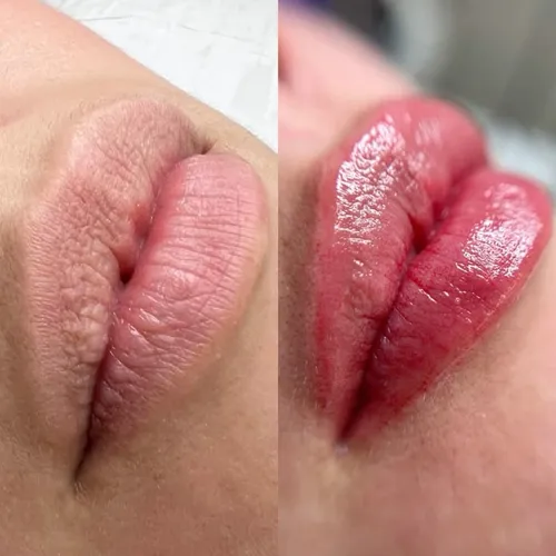 BBlips hidratación 