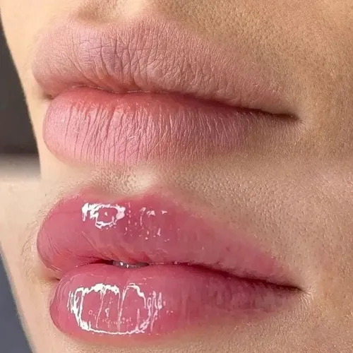 BBlips hidratación 