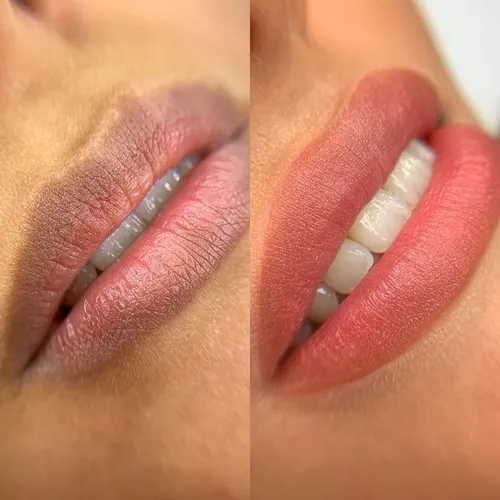 Neutralización de labios 