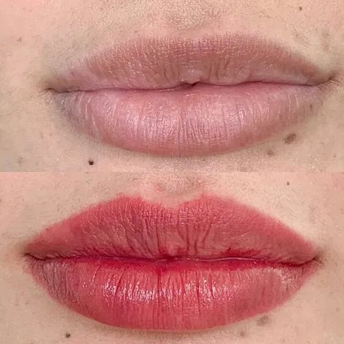 Full lips