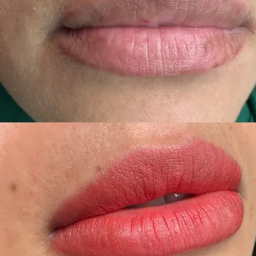 Full lips