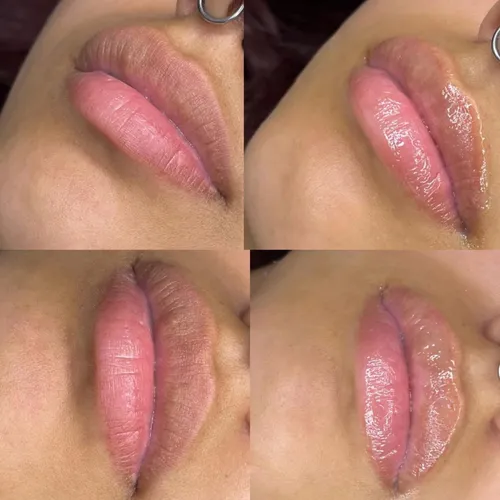 Hidratación de Labios 