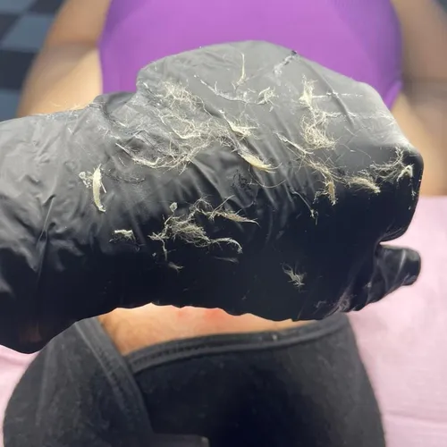 Celulas muertas de la piel que retiramos con Dermaplaning