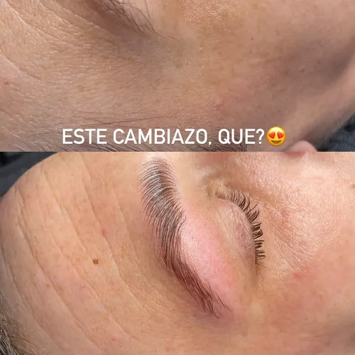 TREMENDO cambio en cejas y arrugas faciales finas💪🏻