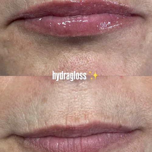 hydragloss 
