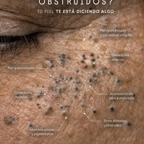 Higiene facial Profunda