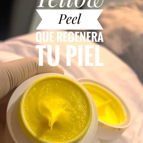 ✨ Yellow Peel Un peeling de última generación que ayuda a renovar la piel, mejorar manchas, etc.