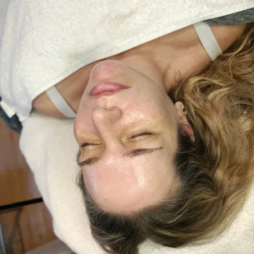 Facial con Exosomas 
