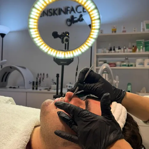 Facial Detox, de Denskinface