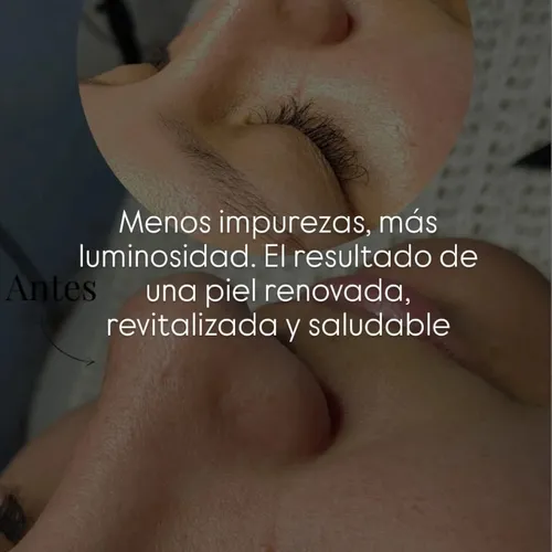 Renovación celular 