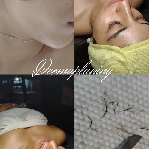técnica de exfoliación que elimina células muertas y el vello fino, dejando la piel más s