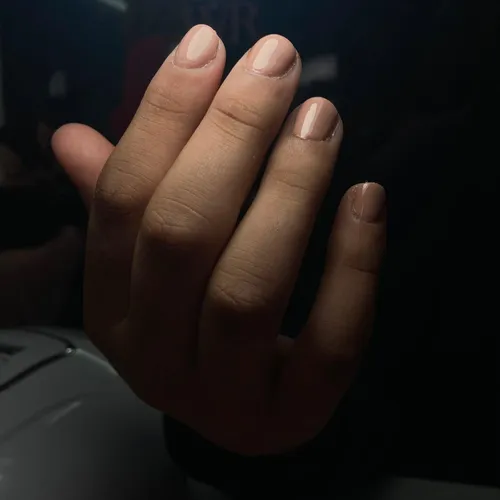 Kapping 