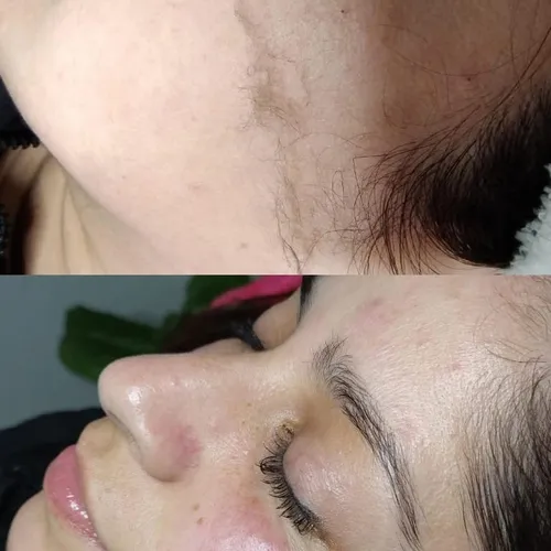 Dermaplaning · Piel Renovada🪄 Exfoliación superficial que elimina células muertas y vello facial, de Bren.Nailstudy 