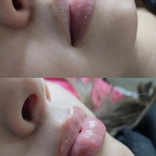 Hidra Lips · Hidratación de Labios Tratamiento hidratante, de Bren.Nailstudy 