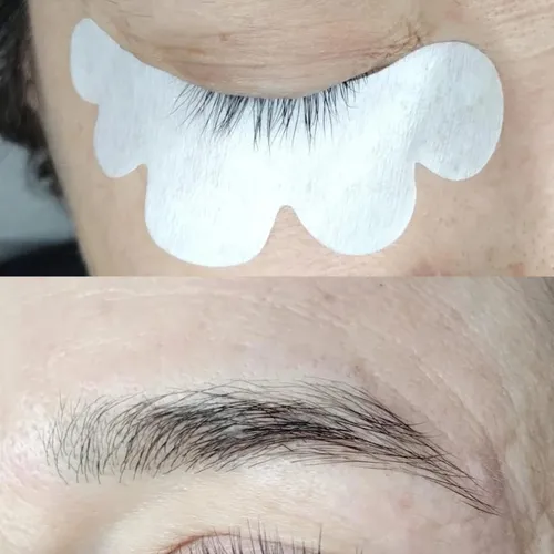 Antes y Despues