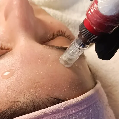 Dermapen