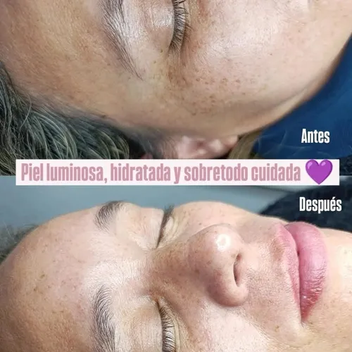 Tratamiento personalizado