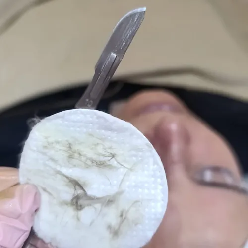 Limpieza Facial Profunda + Dermaplaning
